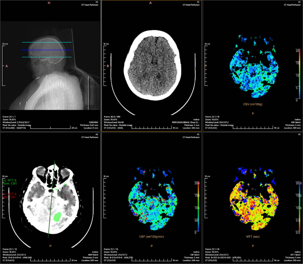 Delivering Enterprise Health Data