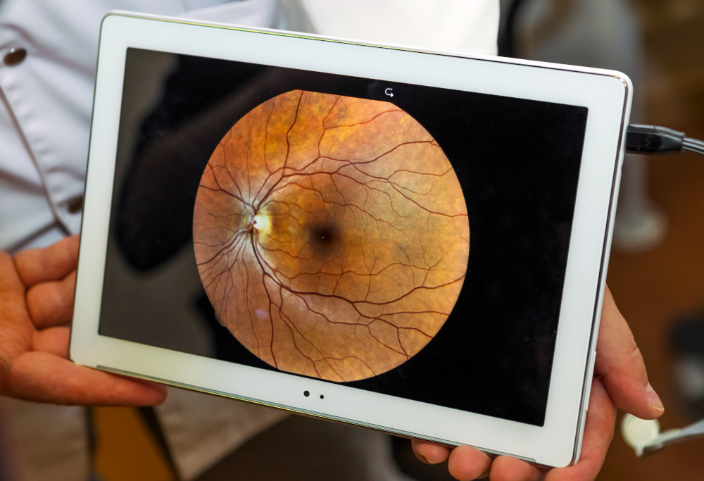 Ophthalmology Migrations